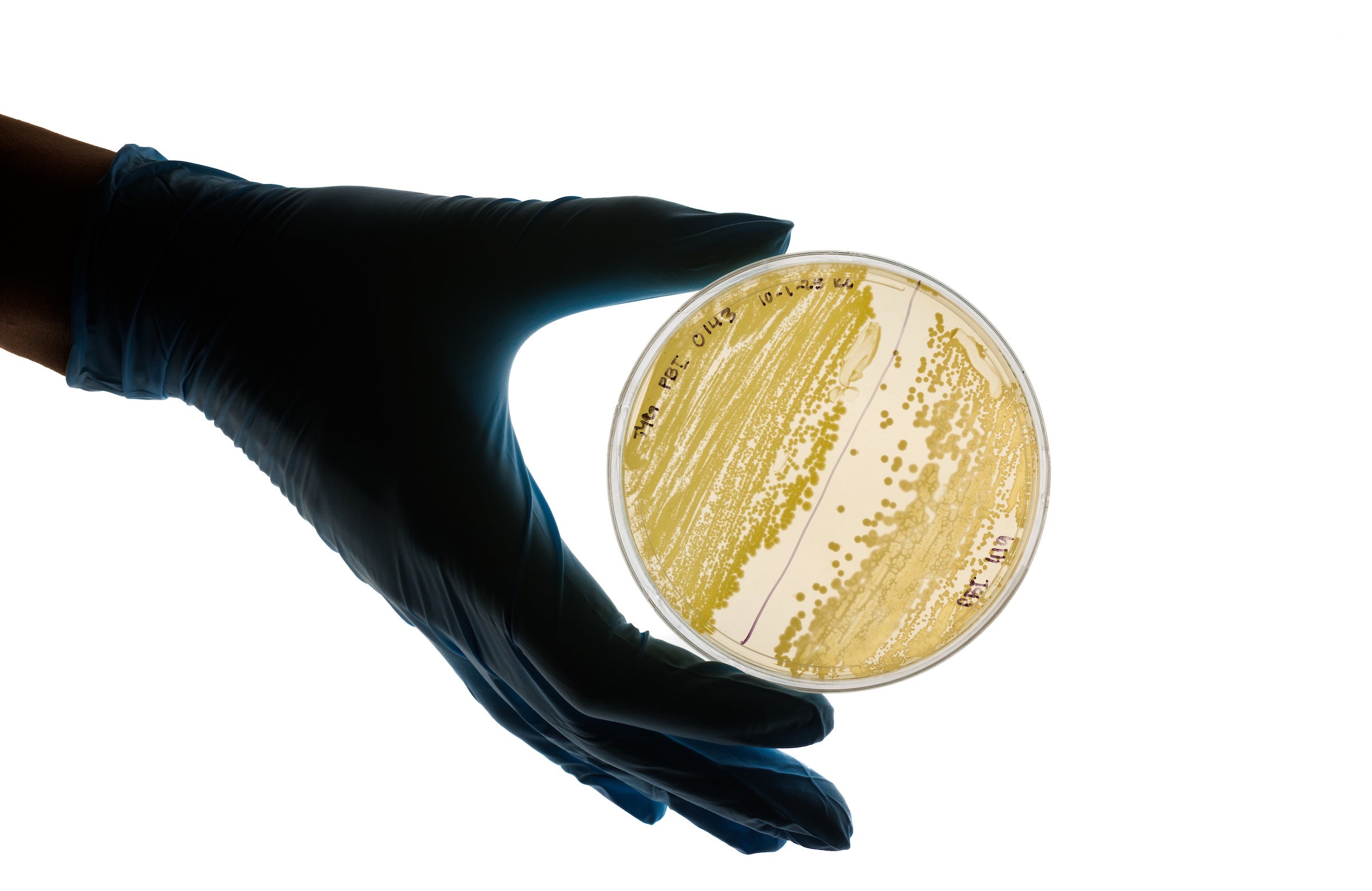 A close-up image of ancient bacteria grown in a Petri dish to study a strain that is millions of years old