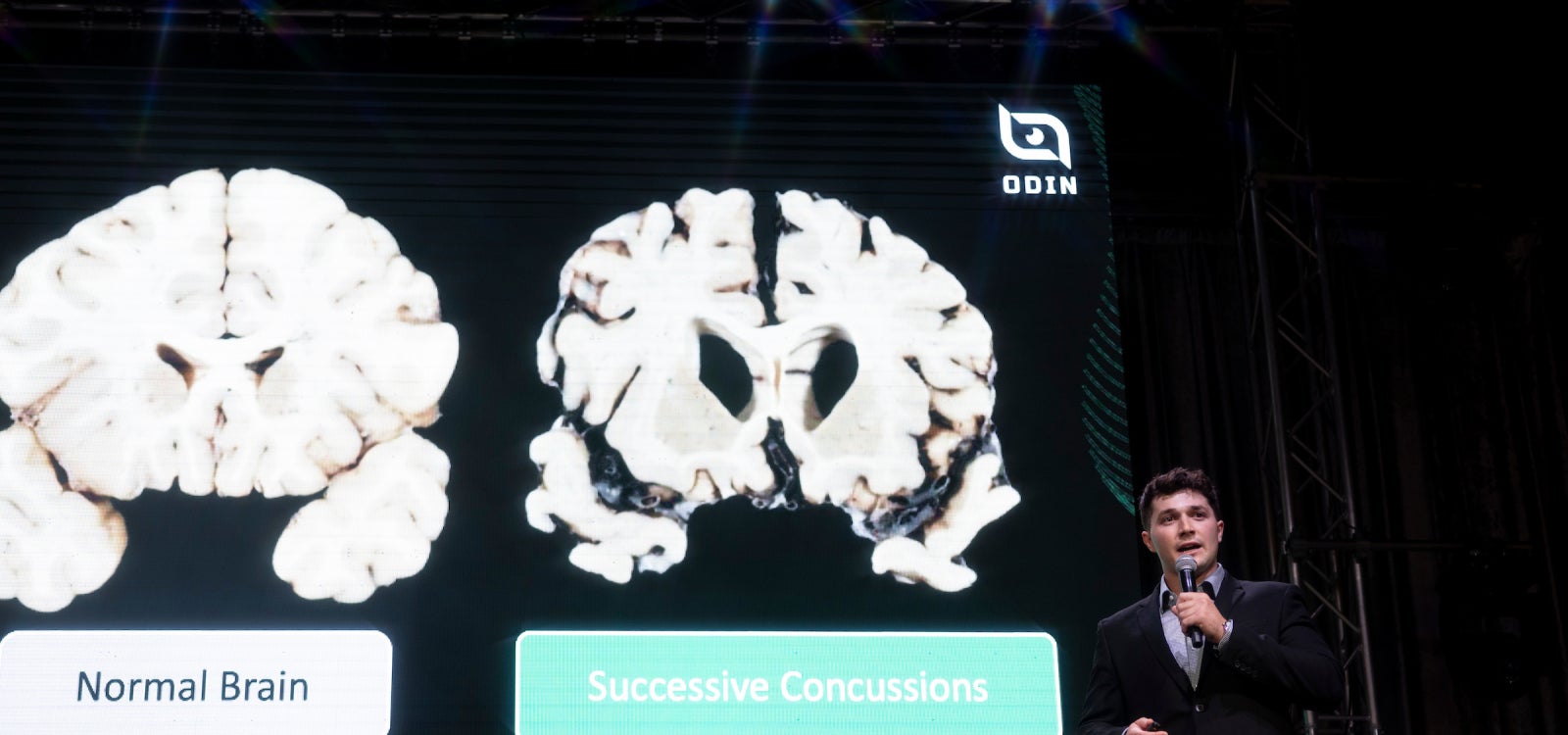 Connor Heffler discusses his startup during the annual Demo Day in front of a slide showing the damage a brain suffers in concussions