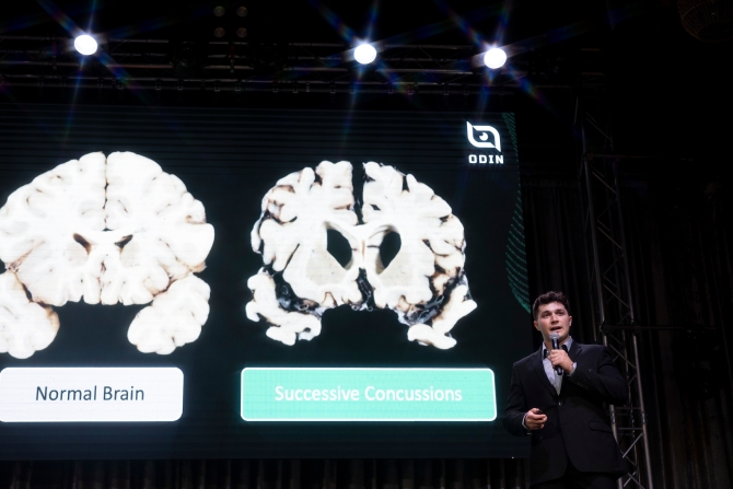 Connor Heffler discusses his startup during the annual Demo Day in front of a slide showing the damage a brain suffers in concussions